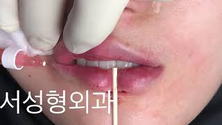 [대한성형외과의사회] '보톡스-필러-실리프팅 연구회'를 소개합니다 / 김종서성형외과 김종서