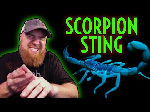 STUNG by the MOST VENOMOUS SCORPION in the USA! Arizona Bark - Centruroides sculpturatus