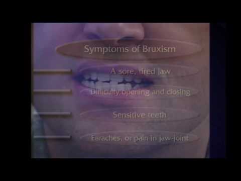 Facial Pain Sleep Apnea Bruxism Symptoms Causes & Treatment Video