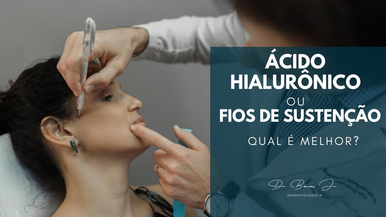 Watch Now Ácido hialurônico ou fios de sustentação! Qual é melhor | Dr. Bones Jr. Ácido hialurônico ou fios de sustentação! Qual é melhor | Dr. Bones Jr.