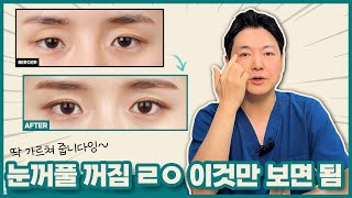 눈꺼풀 꺼짐 ㄹㅇ 이것만 보면 됨 (feat. 눈 성형 장인)