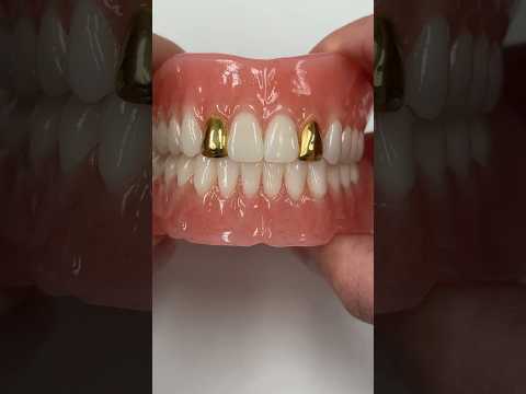 Process Denture with Gold Incisors #dental #smile #teeth #shorts #shortvideo #gold #dentures