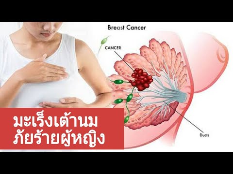 สิ่งที่ฝันหน้าอกเล็ก ฉันมีหน้าอกเล็กและฉันคอมเพล็กซ์