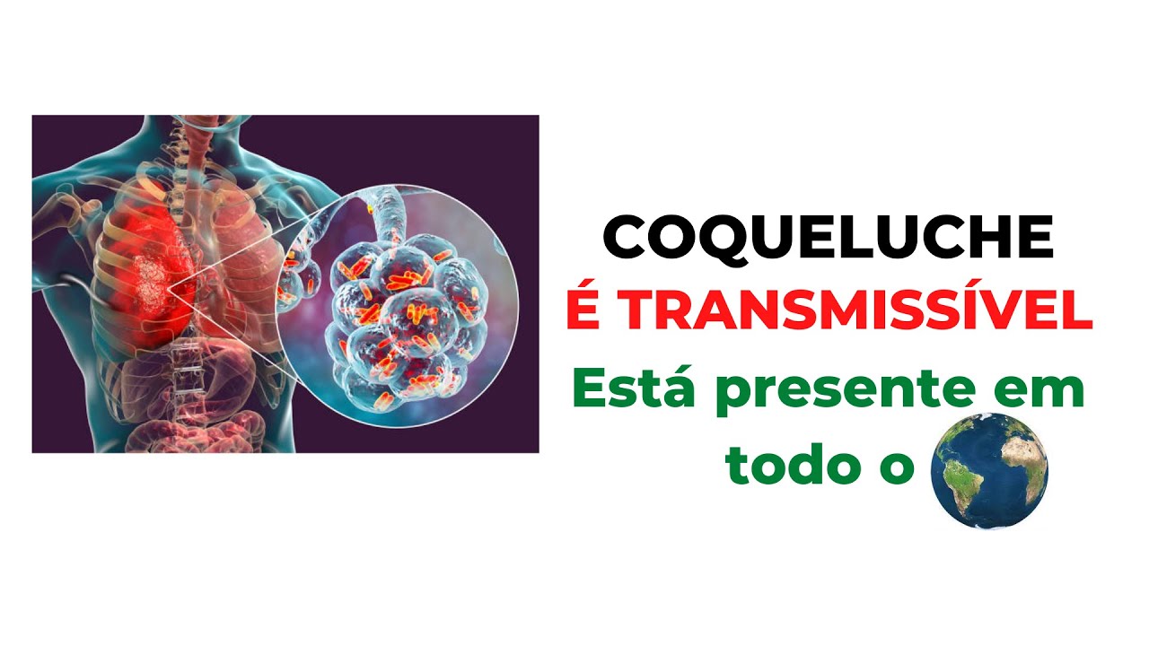 O QUE É COQUELUCHE E QUAIS SÃO OS SINTOMAS - SAIBA TUDO SOBRE A COQUELUCHE