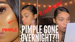 HOW TO: GET RID OF A PIMPLE OVERNIGHT | DRUGSTORE & HIGH END | Briana Monique