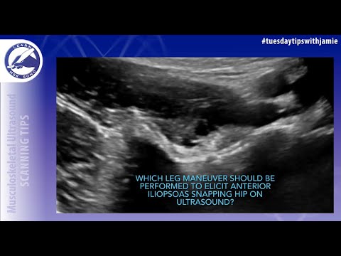 How to capture iliopsoas snapping hip on ultrasound