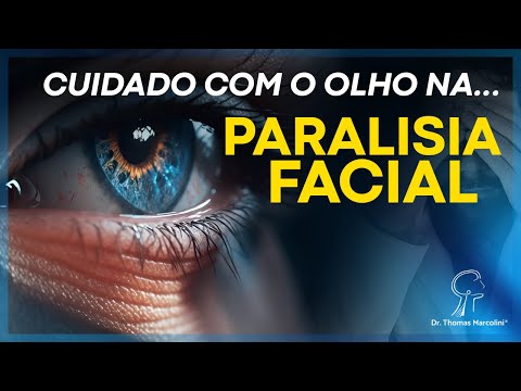 Cuidados com os Olhos após Paralisia Facial: Saiba como protegê-los!