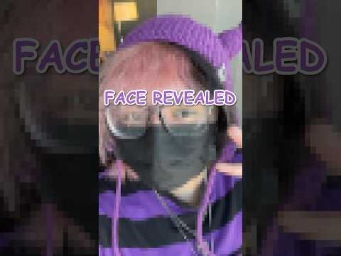 I FACE REVEALED ON ACCIDENT…