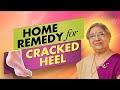 Best Home Remedy For Cracked Heels | 100% natural | Dr Hansaji