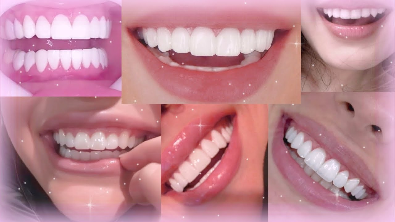 🦷 𓊆ྀི❤︎𓊇ྀི 𝓉eeth 𝒸orrection : proper bite, whitening, straightening and oral hygiene 🪥 ⊹ ࣪ ˖