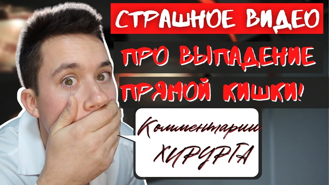 Выпадение ПРЯМОЙ КИШКИ! Страшное видео! Комментарии хирурга!