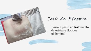 Você sabe como é feito Jato de Plasma para Flacidez e Estrias Abdominais