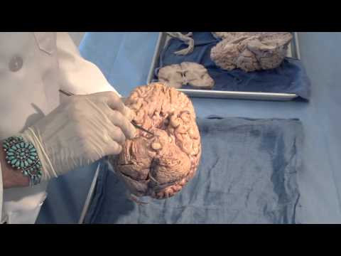 Orientation: The Planes of the Brain: Neuroanatomy Video Lab - Brain Dissections