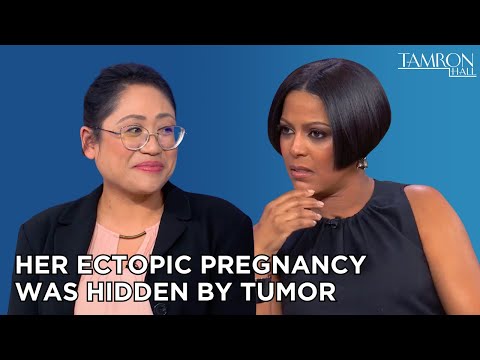 She Experienced an Ectopic Pregnancy Hidden by Tumor
