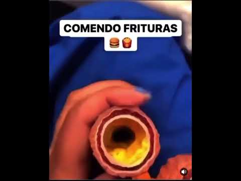 Halison Vilacorta Araújo De Sousa-14