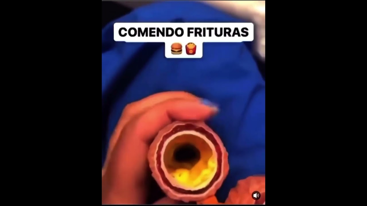 Halison Vilacorta Araújo De Sousa-14