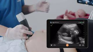 Amniotic Fluid Assessment - Ultrasound Scanning Technique