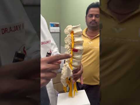 How is the pain in Lumbar spine Slip disc - Dr. Ajay Kothari