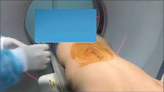 INFILTRATION EPIDURALE LOMBAIRE