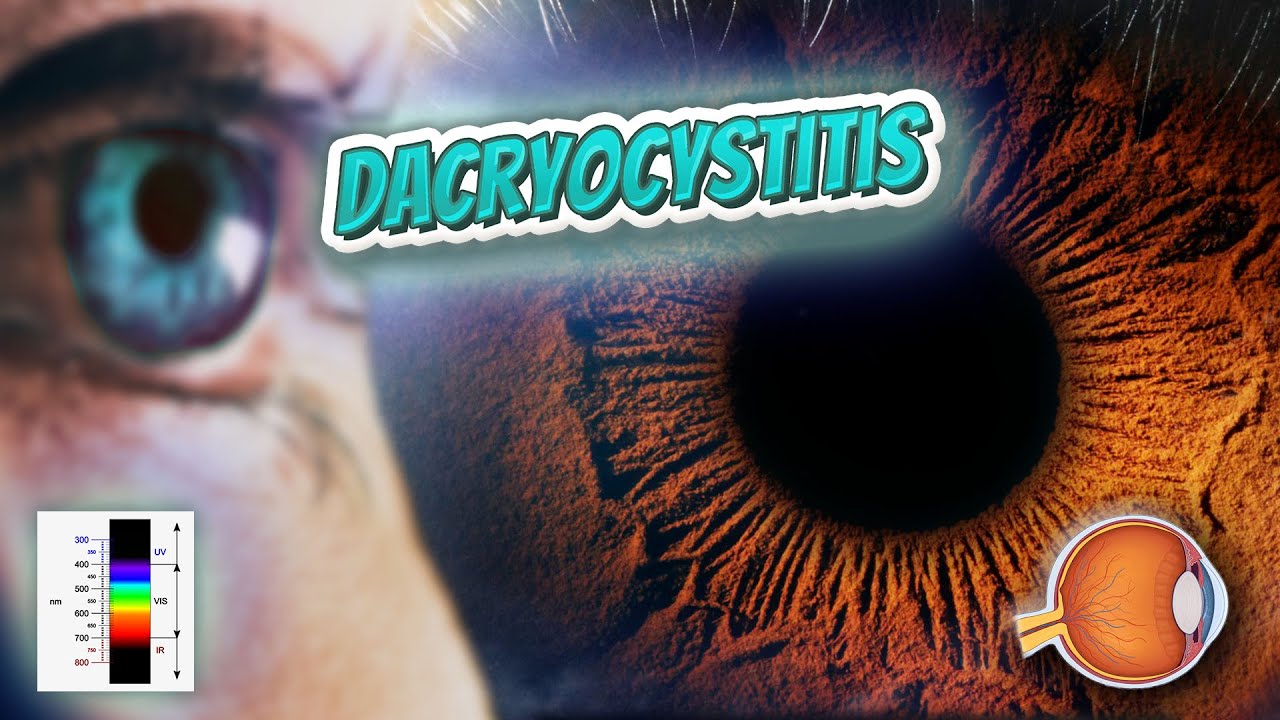 Dacryoadenitis - Your EYEBALLS - EYNTK 👁️👁️💉😳💊🔊💯✅ - YouTube