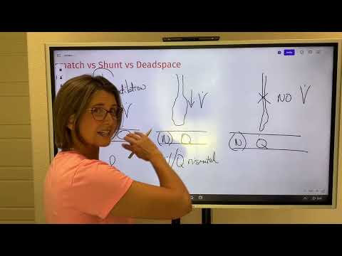 Differentiating Between V/Q Mismatch, Shunt, and Deadspace