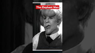 The Elephant Man Joseph Merrick #shorts #elephantman #sideshowfreaks #carnival #circus