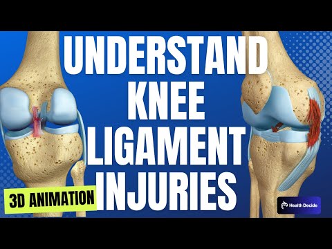 ACL (Anterior Cruciate Ligament) MCL (Medial Collateral Ligament