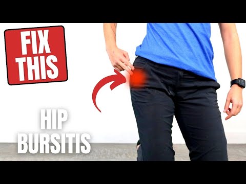 3 BEST Hip Bursitis Stretches to Relieve Pain and Improve Function