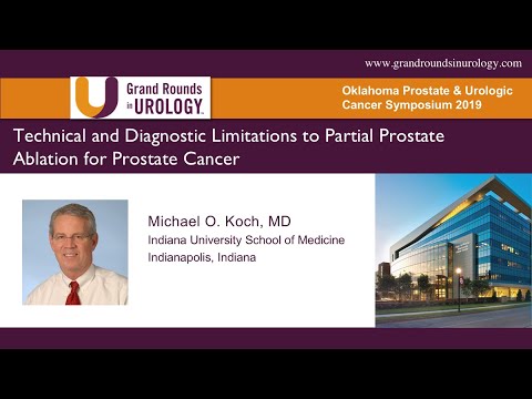 Technical and Diagnostic Limitations to Partial Prostate Ablation for Prostate Cancer