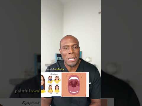 Strep Throat: How Contagious Is It?