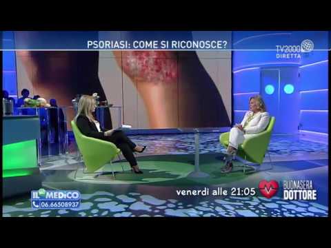 Trattamento da Prednisolonum a eczemi Cura di pelle a dermatite atopic