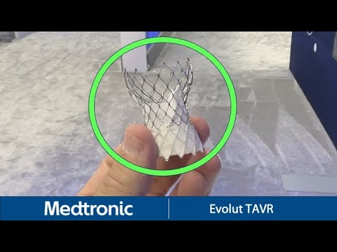Medtronic Evolut Transcatheter Aortic Valve Replacement (TAVR) at TCT 2023