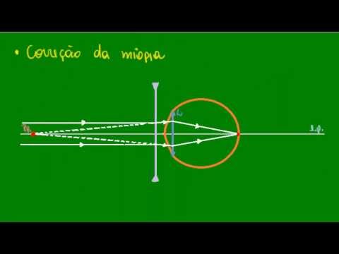 reguli pentru selectarea ochelarilor pentru vedere ochiul anatomie