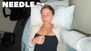 Does Acupuncture Really Work?! 