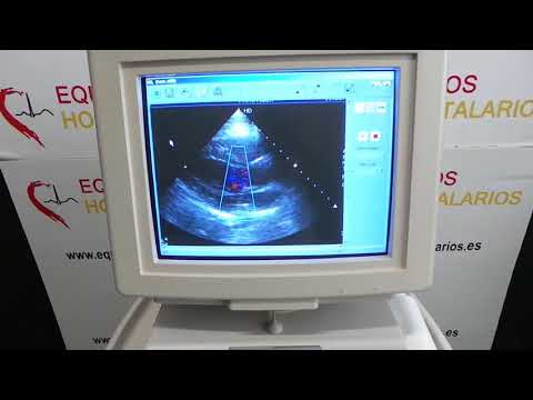 Philips Envisor Refurbished Ultrasound Machine