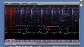 sonicWORX Isolate Vocal Suppression Example