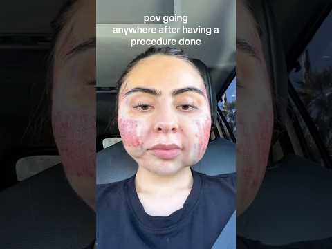 Can you guess what procedure she had done? We’re so excited for her results to show #trusttheprocess