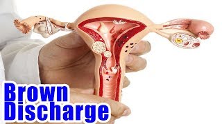 5 CAUSES FOR BROWN DISCHARGE INSTEAD OF YOUR PERIOD.