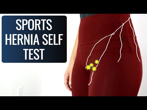 Sports Hernia Self Test (TRY IT)