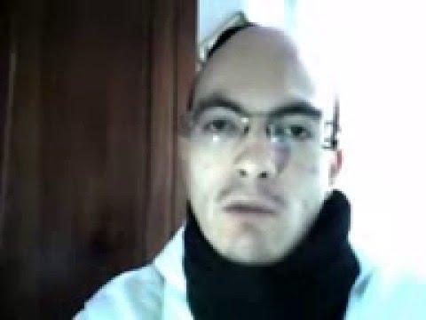Il pigmentary nota a gravidanza chi sarà nato Che tirare le lentiggini di faccia di bambino con