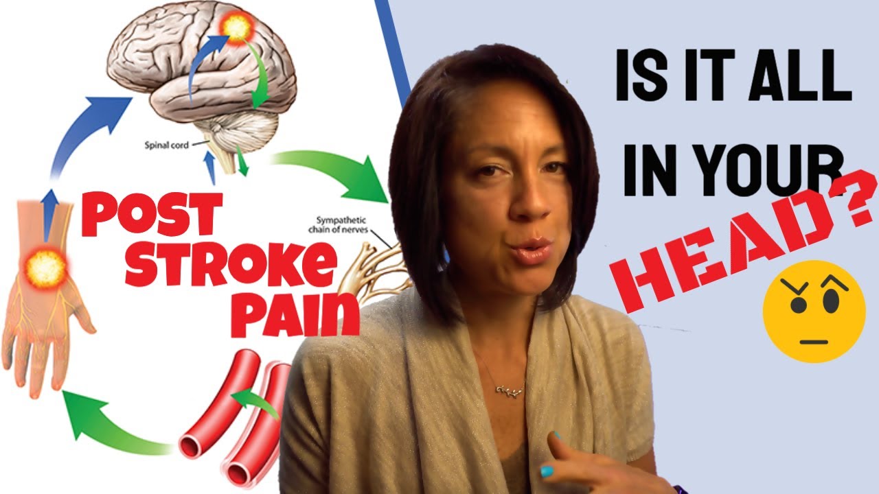 Post Stroke Pain: Fake or Real?
