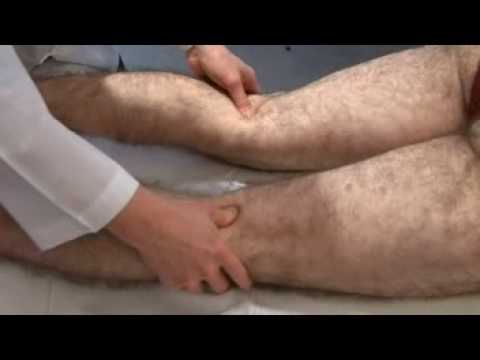 Medikamente mit Osteochondrose und Radikulitis Manuelle Therapie bei Osteochondrose