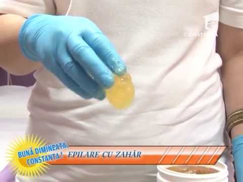 vienuri i tratament mazi i frecare de la varicoza