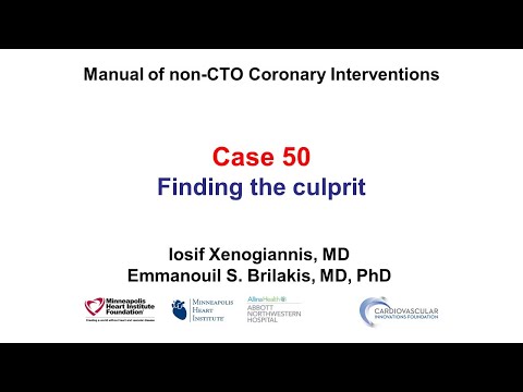Case 50: PCI Manual - Finding the culprit