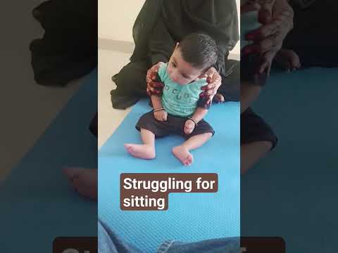 physiotherapy #india #exercises #paediatric #cerebralpalsy #sitting #developmentaldelay #shorts