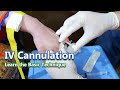 IV Cannulation - Learn the Basic Technique | IV Cannula