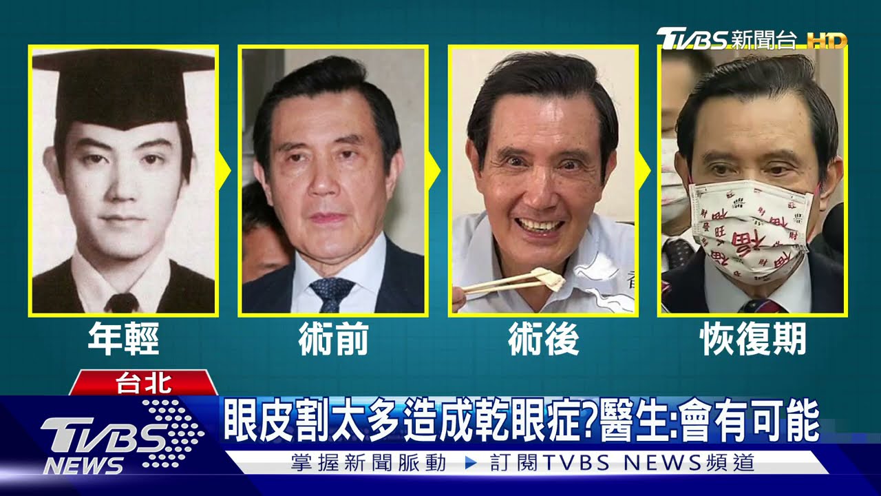 眼皮割太多後遺症?傳馬常回診 治乾眼症