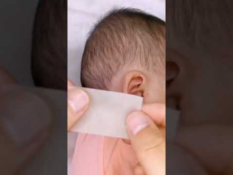 Baby Silicone Gel Ear Corrector.