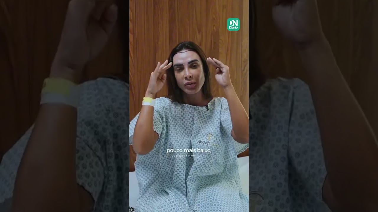 Imagem da notícia Nicole Bahls realiza transplante capilar sem raspagem e surpreende seguidores; 'rosto mais feminino'