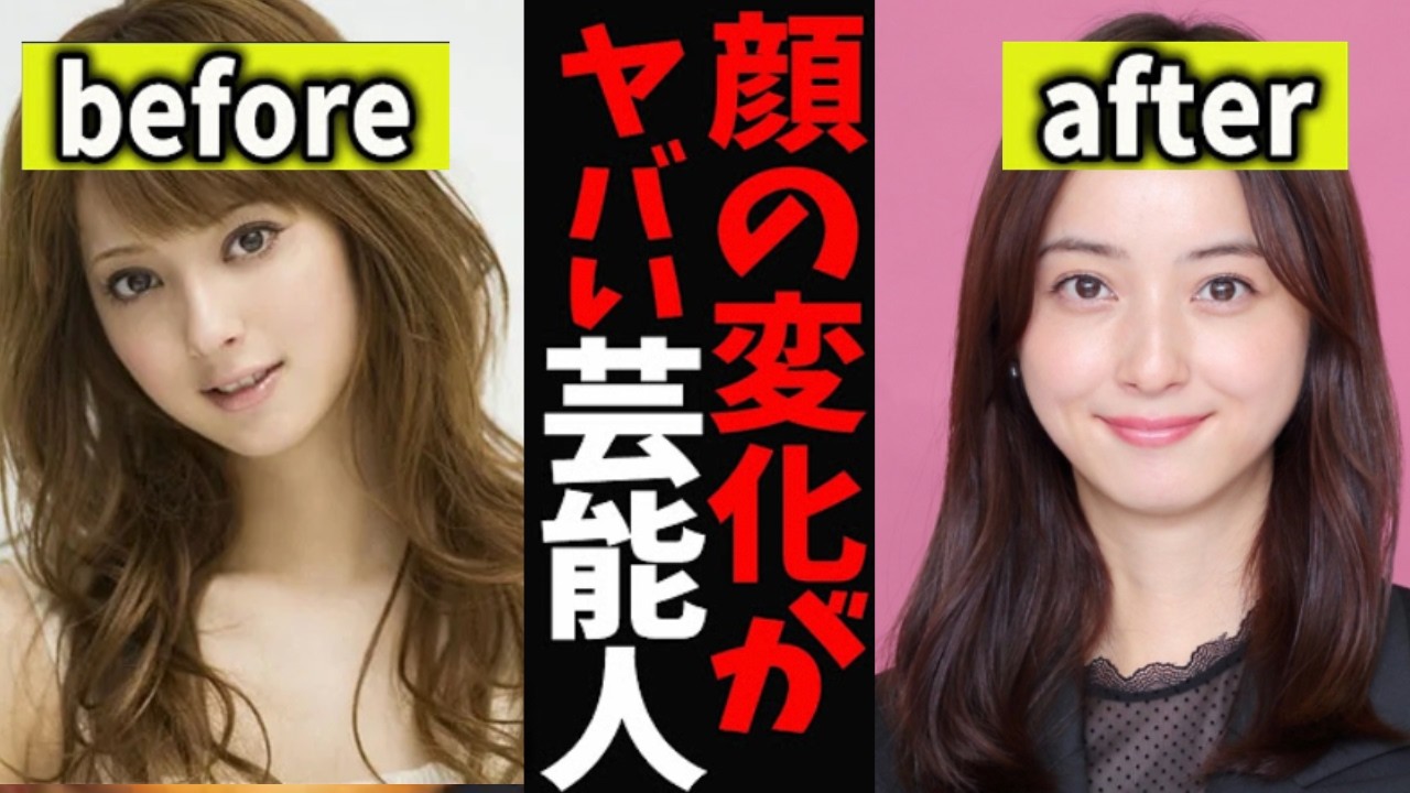 【ガルちゃん芸能】整形...?顔の変化が昔に比べてヤバイ芸能人【有益2ch】
